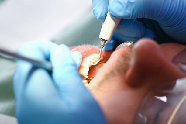 Best Emergency Dental Extractions in Pawnee, OK