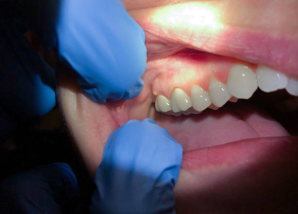 Best Urgent Dental Care for Toothache in Pawnee, OK